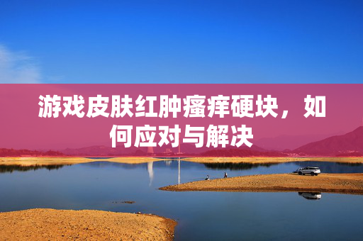 游戏皮肤红肿瘙痒硬块，如何应对与解决