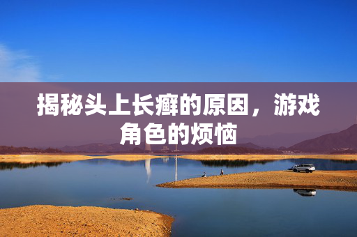 揭秘头上长癣的原因，游戏角色的烦恼